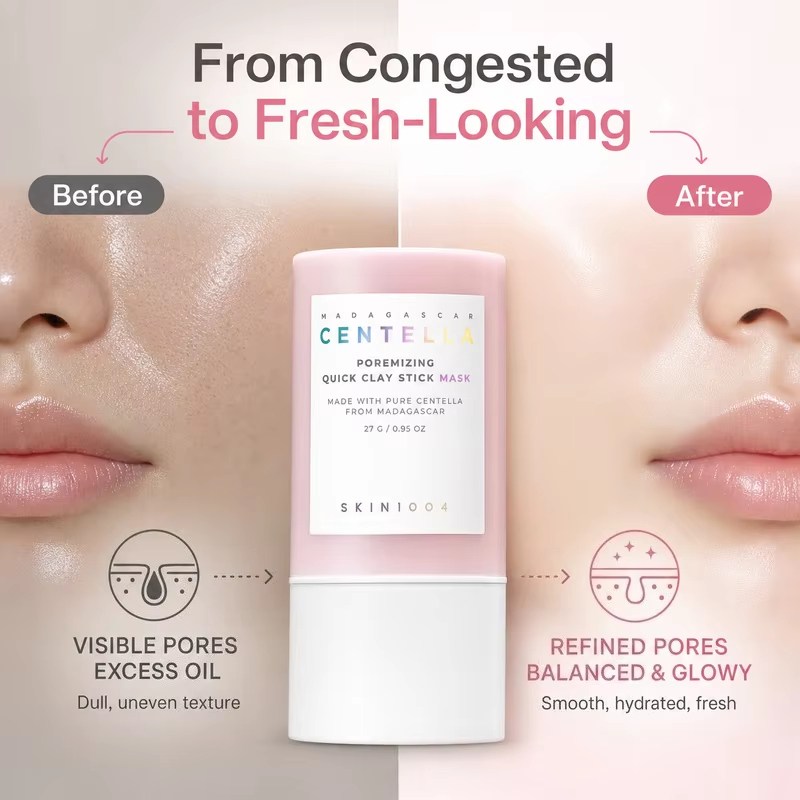 SKIN1004 Kore Centella Gözenek - Dust Mask Construction incelemesi ve fiyatı